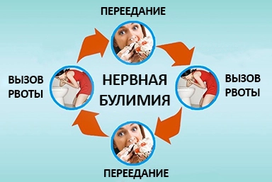 Лечение булимии в Острогожске